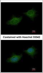 MMP3 Polyclonal Antibody