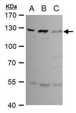 BCL11B Antibody in Western Blot (WB)