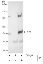 Syk Antibody in Immunoprecipitation (IP)