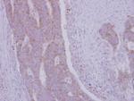 RRM1 Antibody in Immunohistochemistry (Paraffin) (IHC (P))