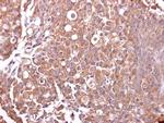MUC4 Polyclonal Antibody