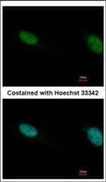 PBRM1 Polyclonal Antibody
