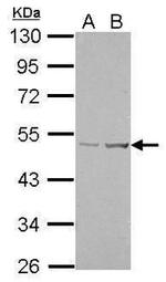 LOX Antibody in Western Blot (WB)