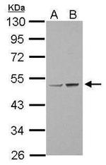 LOX Antibody in Western Blot (WB)