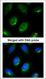 Laminin beta-1 Polyclonal Antibody