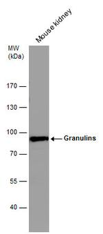 Granulins Antibody in Western Blot (WB)