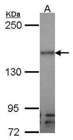 VEGF Receptor 3 Antibody in Western Blot (WB)