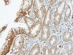 BMPR1A Antibody in Immunohistochemistry (Paraffin) (IHC (P))