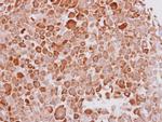 Cytokeratin 16 Polyclonal Antibody
