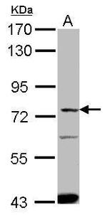 SLC27A4 Polyclonal Antibody