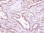 Calmyrin Polyclonal Antibody