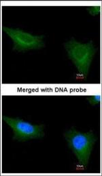 TTLL1 Polyclonal Antibody