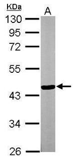 TTLL1 Antibody in Western Blot (WB)