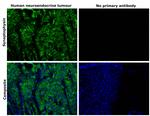 Synaptophysin Antibody in Immunohistochemistry (Paraffin) (IHC (P))