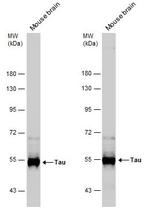 Tau Antibody in Western Blot (WB)