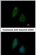 BMP-4 Antibody in Immunocytochemistry (ICC/IF)