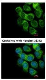 Thymidine Phosphorylase Polyclonal Antibody