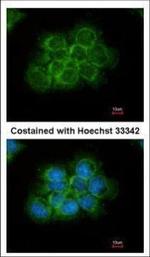 Crk Polyclonal Antibody