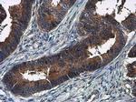 Amphiregulin Polyclonal Antibody