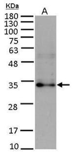 FGF10 Polyclonal Antibody