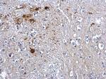 PTEN Antibody in Immunohistochemistry (Paraffin) (IHC (P))