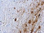 PTEN Antibody in Immunohistochemistry (Paraffin) (IHC (P))