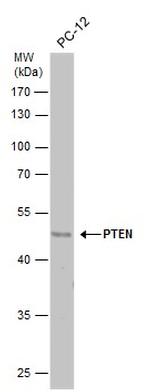 PTEN Antibody in Western Blot (WB)