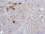 PTEN Antibody in Immunohistochemistry (Paraffin) (IHC (P))