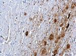 PTEN Antibody in Immunohistochemistry (Paraffin) (IHC (P))
