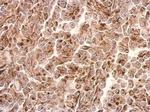 PTEN Antibody in Immunohistochemistry (Paraffin) (IHC (P))