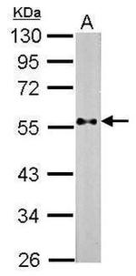 PTEN Antibody in Western Blot (WB)