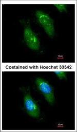 SMN1 Polyclonal Antibody