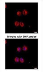 14-3-3 zeta Antibody in Immunocytochemistry (ICC/IF)