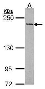 WRN Antibody in Western Blot (WB)