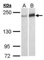 WRN Antibody in Western Blot (WB)