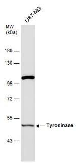 Tyrosinase Antibody in Western Blot (WB)