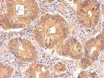 INSR Antibody in Immunohistochemistry (Paraffin) (IHC (P))