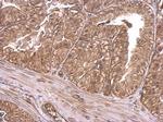 INSR Polyclonal Antibody