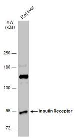 INSR Antibody in Western Blot (WB)