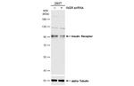 INSR Antibody in Western Blot (WB)