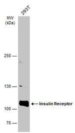 INSR Antibody in Western Blot (WB)