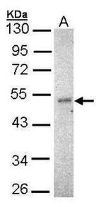 IKK gamma Antibody in Western Blot (WB)