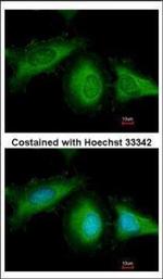 HSC70 Antibody in Immunocytochemistry (ICC/IF)