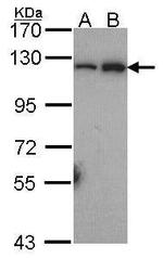 NFkB p100 Polyclonal Antibody
