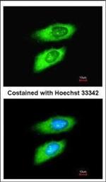 MIF Antibody in Immunocytochemistry (ICC/IF)