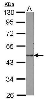 LIPA Polyclonal Antibody