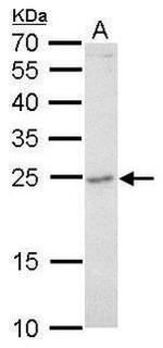 GRB2 Antibody in Western Blot (WB)