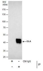 alpha Galactosidase Antibody in Immunoprecipitation (IP)