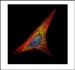 Gelsolin Polyclonal Antibody