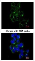 Fyn Polyclonal Antibody